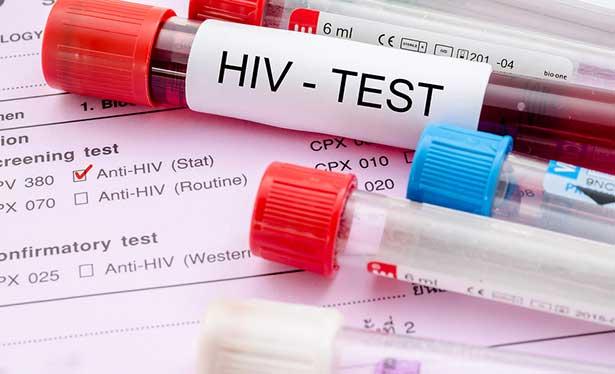 'HIV virüsünün tamamen tedavisi mümkün olacak'