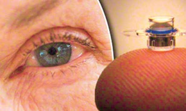 Göze implant devri