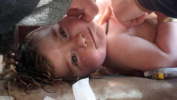 Suriye'de kullanılan sinir gazları nasıl etki ediyor, tedavide neler yapılmalı?