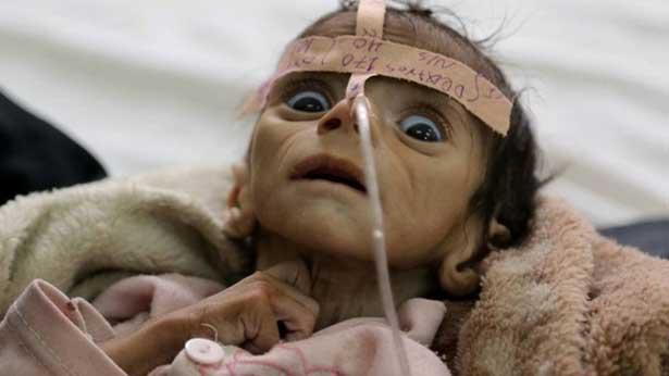 Yemen'den korkutan haber: Sağlık sistemi çöküyor...
