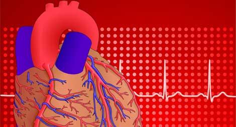 Kalp krizinde ilk ne yapılmalı?