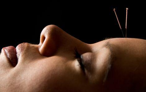 Doktorlara akupunktur tavsiyesi: FDA ağrı yönetiminde yeni alternatifler arıyor