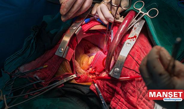 Aort anevrizması akciğere açılan hasta literatüre girecek