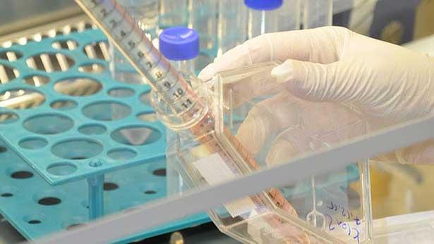 Bilim insanları ilke imza attı: Laboratuvarda insan damarları büyütüldü