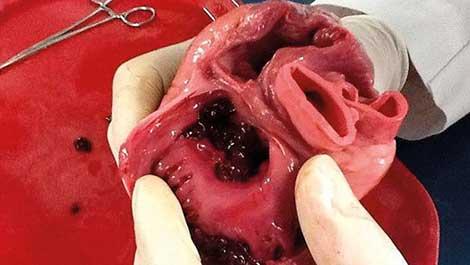 Türk bilim insanları, kalp kası dokusu geliştirdi 