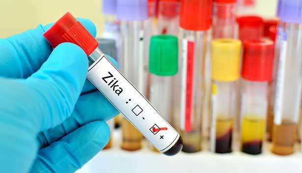 ABD'de bağışlanan tüm kanlarda Zika virüsü bakılacak