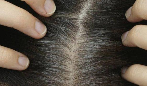 Kovid-19 hastaları, koronavirüsün yeni etkisini bildirdi: Saç dökülmesi