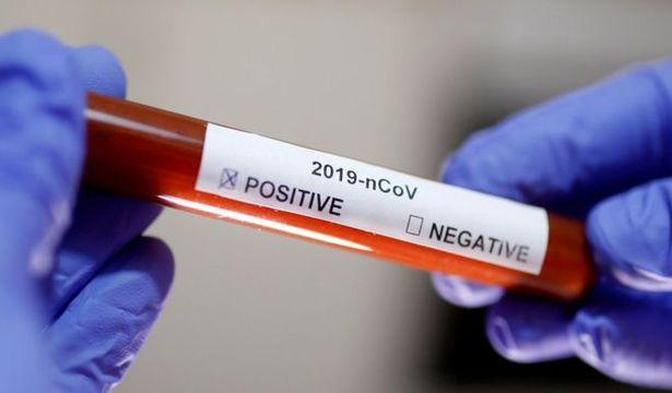 ABD’de koronavirüsten ölenlerin sayısı 6 bini geçti