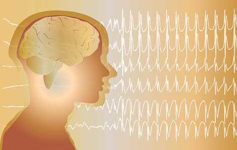 Türkiye’de 10 kişiden 1’i ‘epilepsi bulaşıcı’ dedi