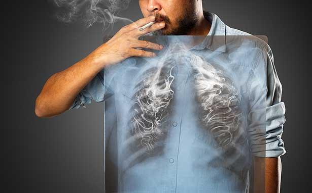 Prof. Dr. Ülkü Yılmaz: Ağır sigara içen bir bireyin akciğer kanserine yakalanma riski yüzde 30'larda