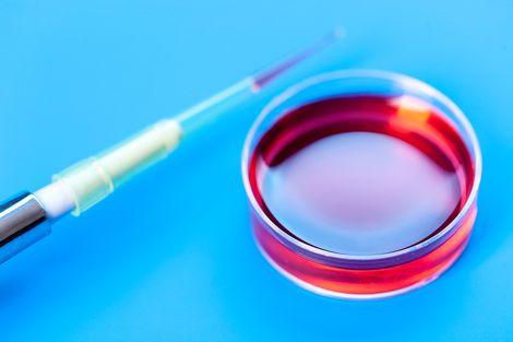 Bilim insanları 10 yıl içinde insanların ölüp ölmeyeceğini belirleyen kan testi geliştirdi
