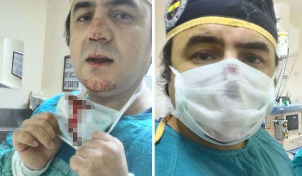 Doktorun burnunun kırıldığı saldırının görüntüsü ortaya çıktı