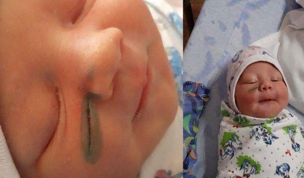 'Yanlışlıkla' oldu: Rusya'da doktorlar doğum sırasında bebeğin yüzünü kesti!