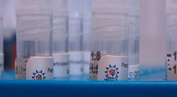 Oxford ve AstaZeneca'nın ortak aşı üretimi: Klinik deneyler devam ediyor, Hazirana hazır!
