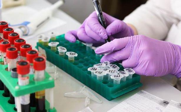 75 gündür koronavirüs vakası görülmeyen KKTC'de 4 yeni vaka tespit edildi
