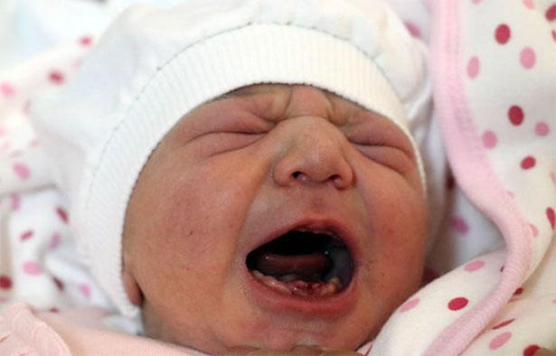 Doktorlar da şoke oldu! Bebek dokuz diş ile doğdu