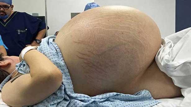 Hamile olduğunu düşünüyordu, doktora gittiğinde büyük şok yaşadı!