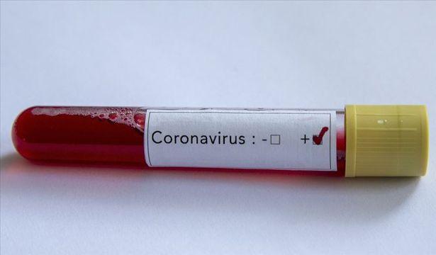 20 doktor bir günde Türkçe'ye çevirdi! Koronavirüs hastalarında bilinç kaybı detayı...
