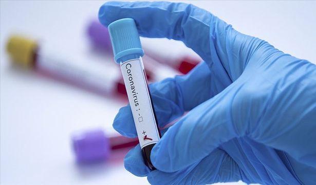 Koronavirüs: İngiltere'de geliştirilen protein tedavisi 'bir dönüm noktası olabilir'