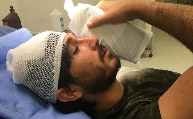 Aile hekimi darbedildi Haluk Levent sosyal medyada isyan etti: 'Doktorsuz kalabiliriz'
