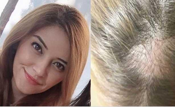 Hasta yakını 112 görevlisi kadının saçlarını kopardı