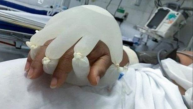 Brezilya'da hemşirelerden Covid-19 hastalarına özel eldiven