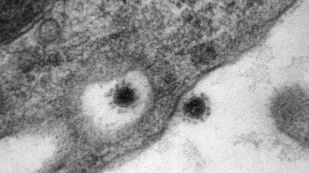 Rusya'da koronavirüsün Delta Plus mutasyonu görüntülendi