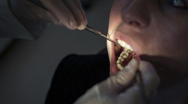 AB vatandaşı diş hekimlerinin ülkeden ayrılması İngiltere'de diş tedavisi sıkıntısı yarattı 