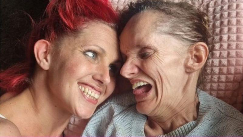 Nöroferritinopati: Vücutlarına hapsolan kız kardeşler için tedavi umudu