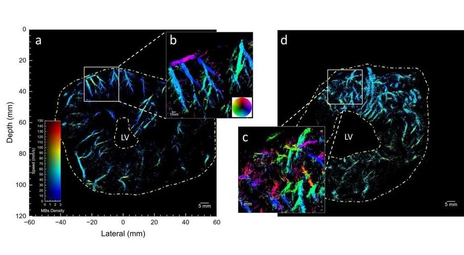 Mikroskobik kalp damarları ilk kez süper çözünürlükte görüntülendi