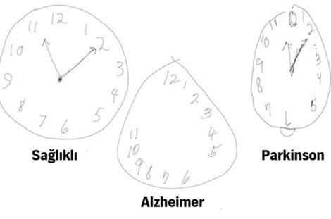 Pfizer, Alzheimer ve Parkinson ilaçları araştırmalarına son verdi