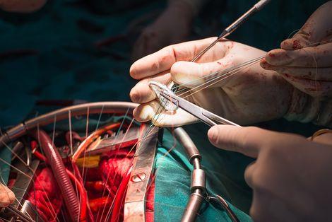 Tatvan Devlet Hastanesi, açık kalp ameliyatlarına başlıyor