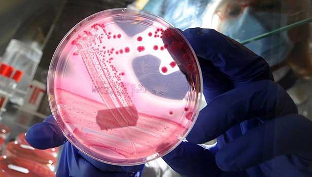 Bakterilerde direnci önleyen antibiyotik bulundu