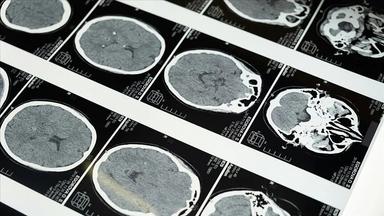 Dünyanın en güçlü MRI cihazıyla çekilen insan beyninin en net görüntüsü yayınlandı