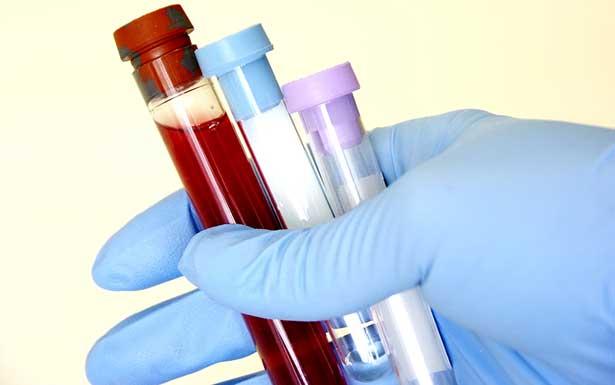 Virüs tedavisi için yeni yöntem: Kan temizleme