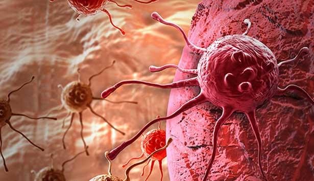 Araştırmacılardan kanser tedavisine yeni yöntem: Nano parçacıklarla ısıtma tedavisi