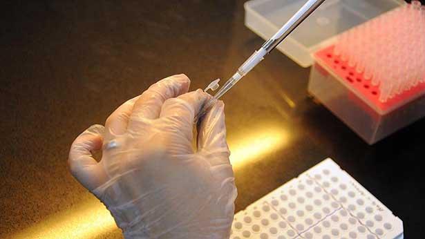 California Üniversitesi koronavirüsün yüzeylerden bulaşma ihtimalinin düşük olduğunu bildirdi