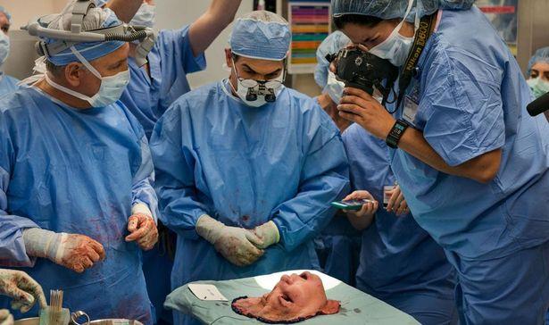 Amerika'da yüz nakli ameliyatında çarpıcı fotoğraf gündem oldu 